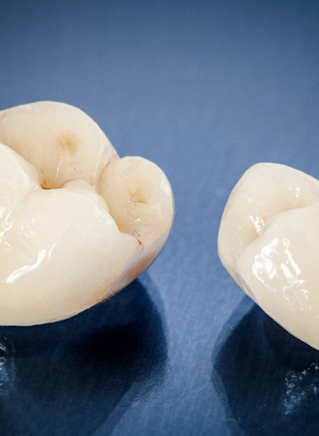 Close-up of two dental crowns in Manchester, NH