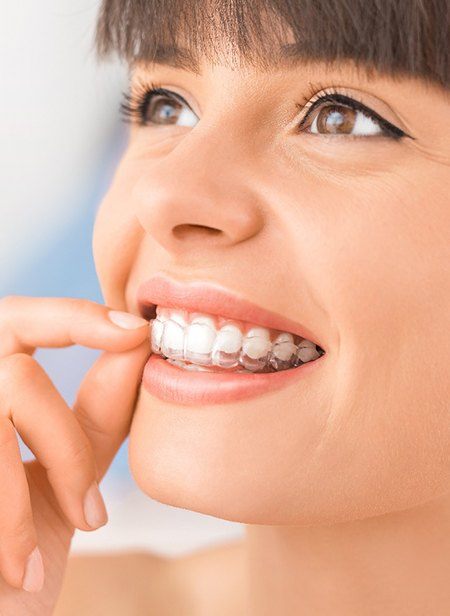 Woman putting in her Invisalign trays