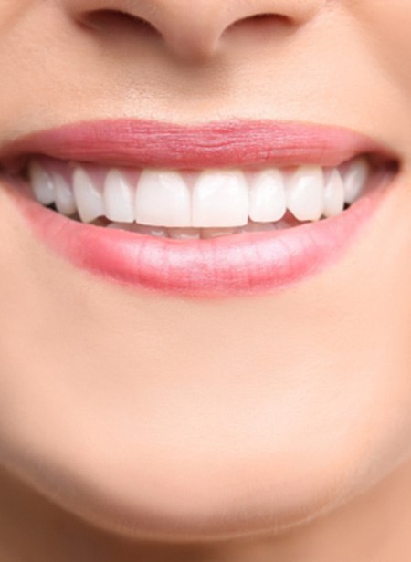 Closeup of woman smiling with cosmetic dental bonding in Manchester