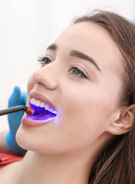 Woman receiving cosmetic dental bonding