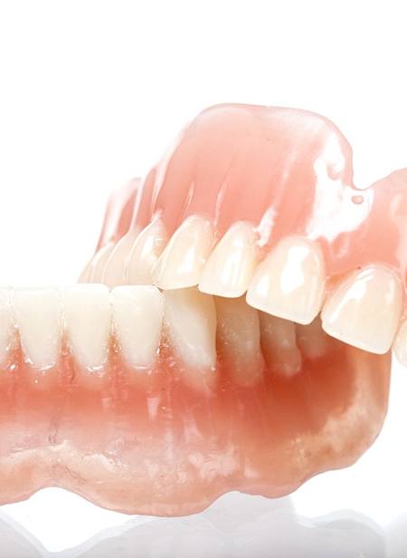 An up-close image of a full denture set custom-made for a patient with missing teeth on the top and bottom arches