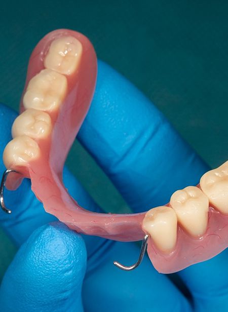 A gloved hand holding a partial denture designed to fit along the bottom arch