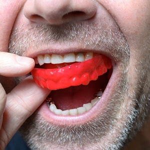 Closeup of man taking out his red mouthguard