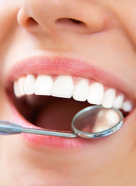 Dentist checking patient's smile after tooth colored filling restorative dentistry treatment