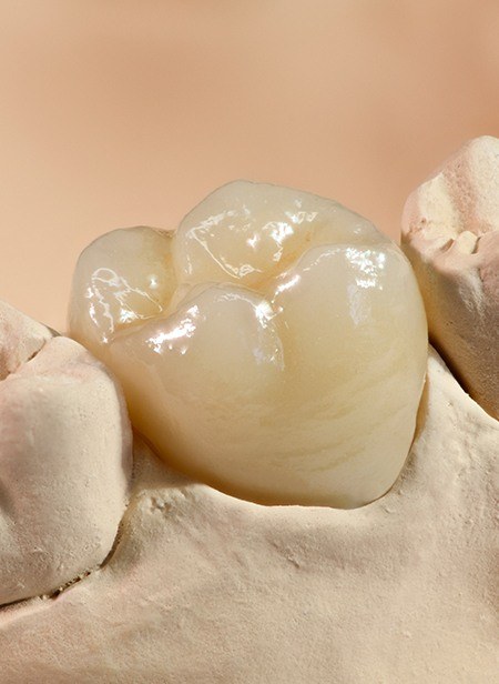 Model smile with dental crown restoration