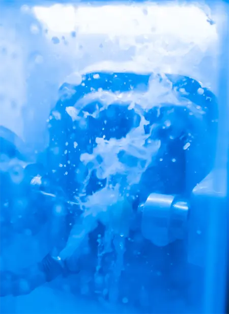 Man and woman with dentures smiling