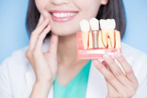 Dentist holding model of dental implant.